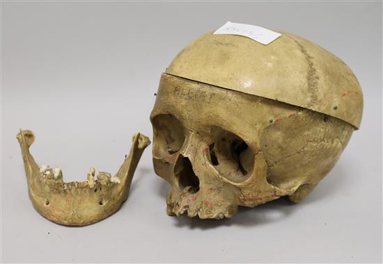 A human anatomical skull
